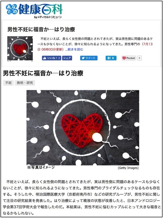 男性不妊症の臨床 男性不妊の新規バイオマーカー候補となるタンパク質を発見 | YCU